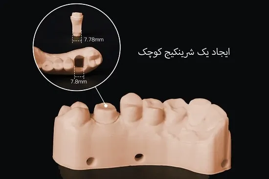 علل اهمیت شرینکیج