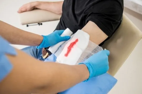 استفاده از گاز استریل بیشتر در صورت خون ریزی
