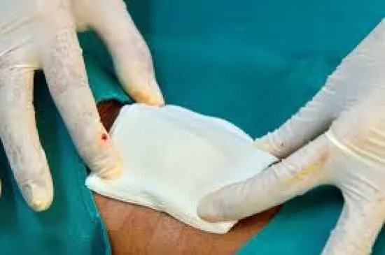 گاز برای پانسمان زخم