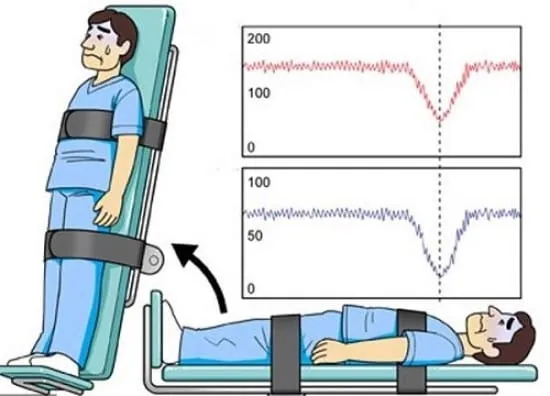 تشخیص syncope